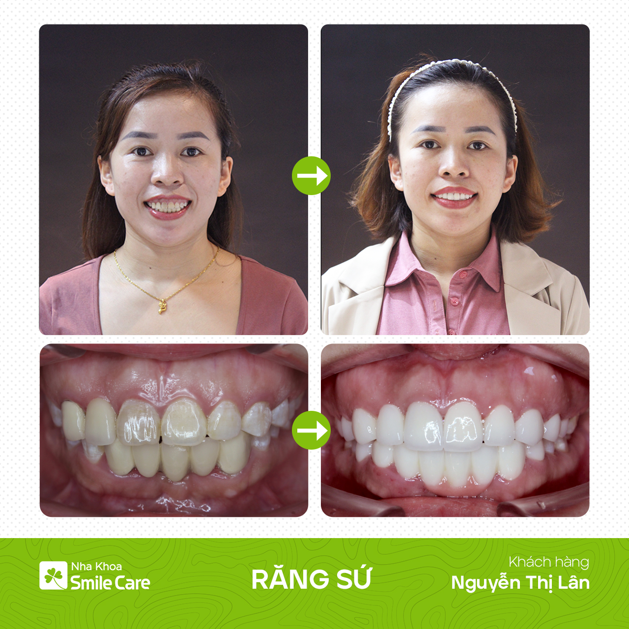 B-A Nguyễn Thị Lân