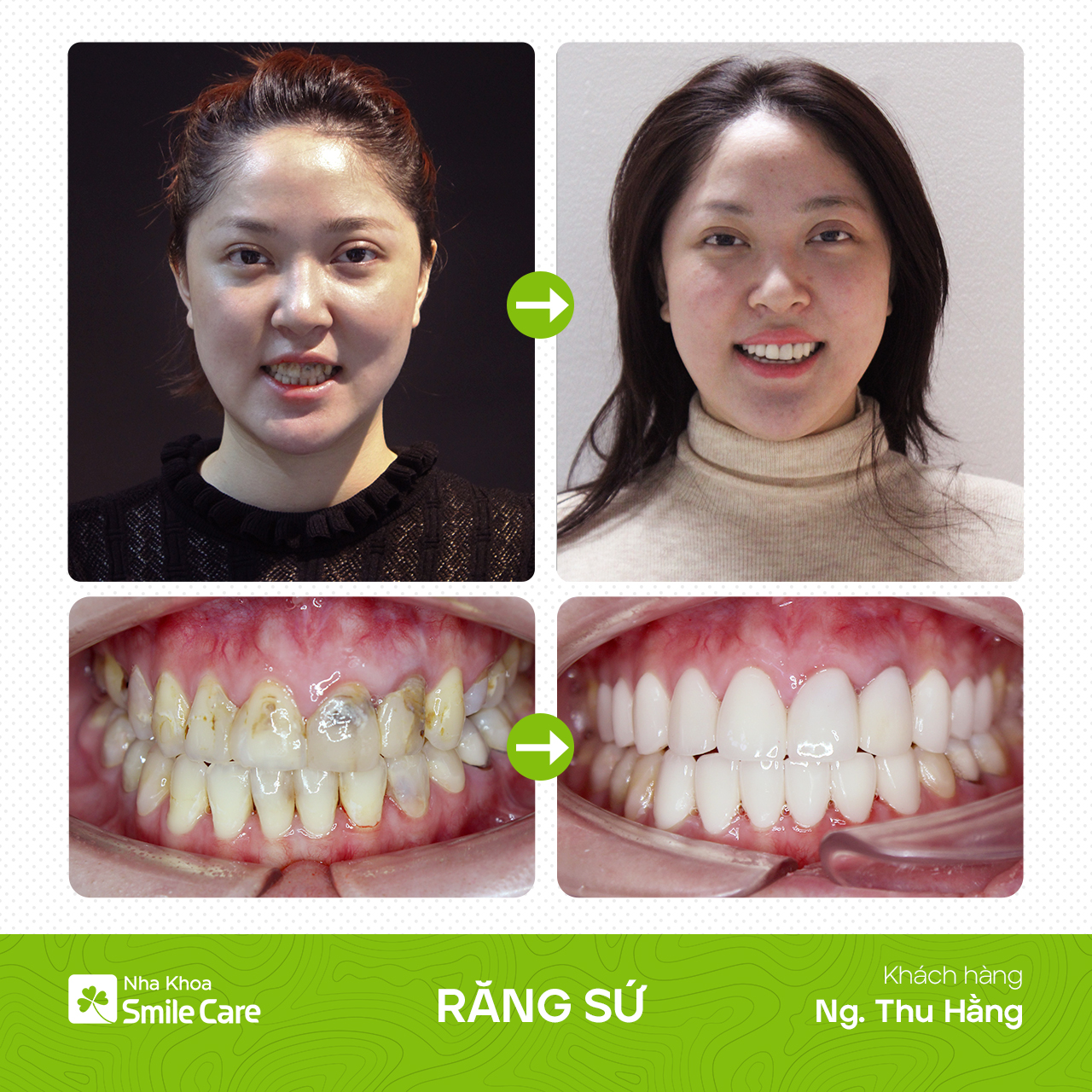 B-A Nguyễn Thu Hằng 1