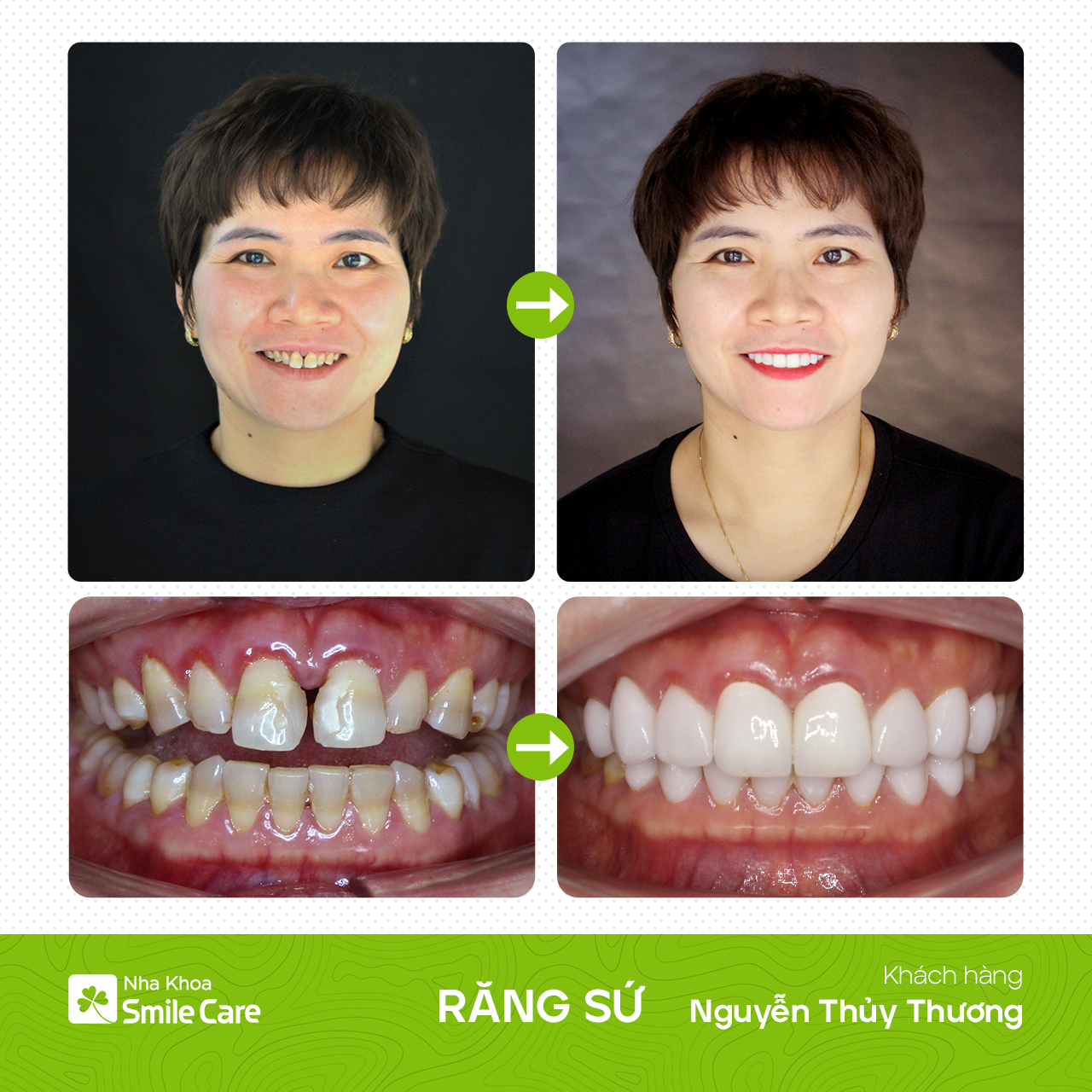 B-A Nguyễn Thủy Thương